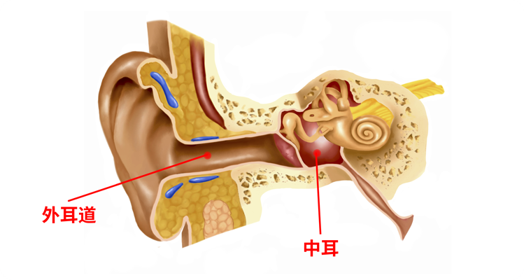 病变在耳朵"外面",一个在耳朵"里面",以鼓膜为界,鼓膜以外都是"外耳"