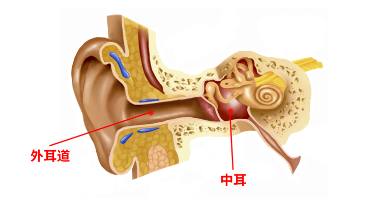 外耳道炎和中耳炎是一个病变在耳朵"外面",一个在耳朵"里面",以鼓膜为