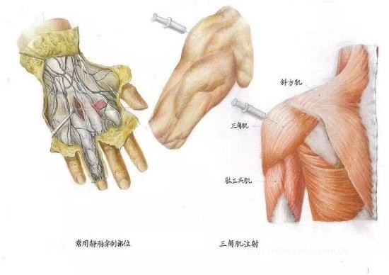 三等奖作品《常见护理技能(手背静脉网给药,三角肌注射解剖示意图)》