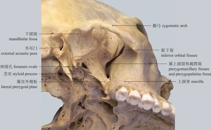 图1-31 颞下窝和翼腭窝 infratemporal fossa and pterygopalatine