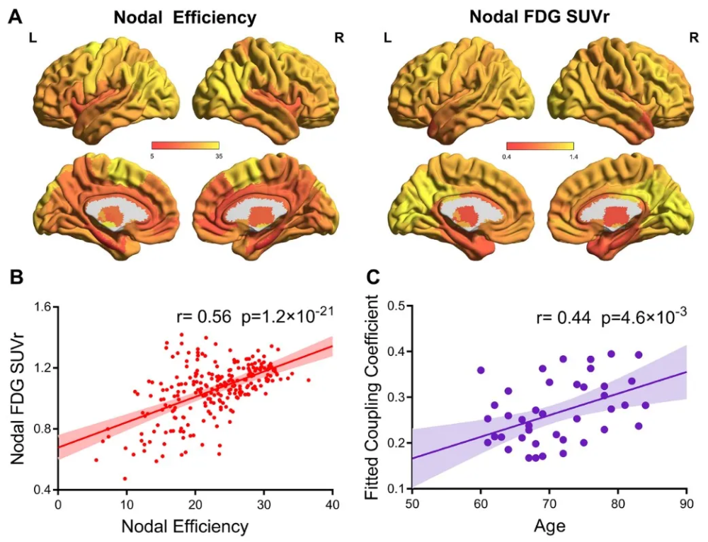 图1 正常老化脑白质连接效率和葡萄糖代谢水平之间的空间耦合性