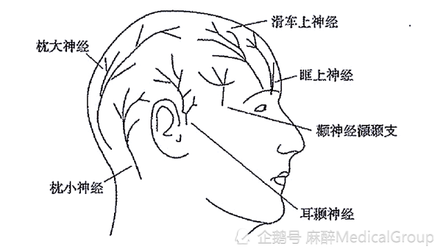 没有外科的配合,再好的麻醉设计也用不出来:一次艰难的头皮神经阻滞
