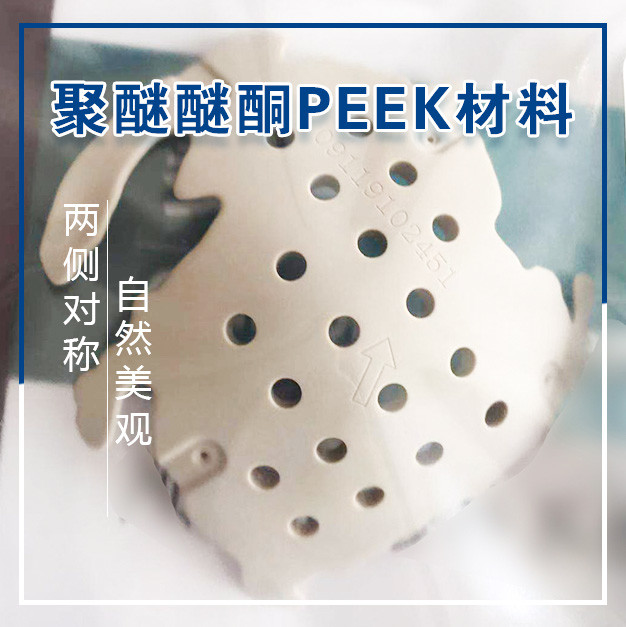 做聚醚醚酮peek颅骨修复整形费用多少