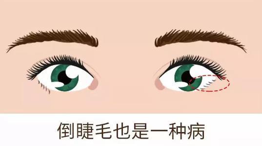 左眼跳财,右眼跳灾?连跳8年,这个迷信终于应验了
