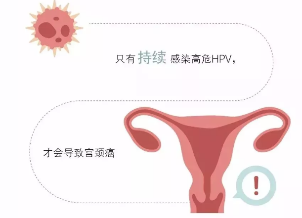 7成以上女性都会感染的hpv病毒,2种情况要提前知道