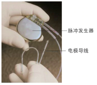 传统的心脏病起搏器是由脉冲发生器和电极导线共同组成的能够植入体内