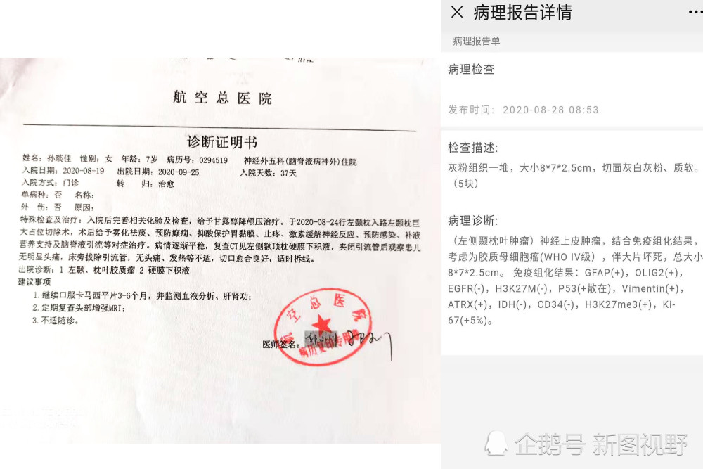 图为医院的诊断证明书和病理报告