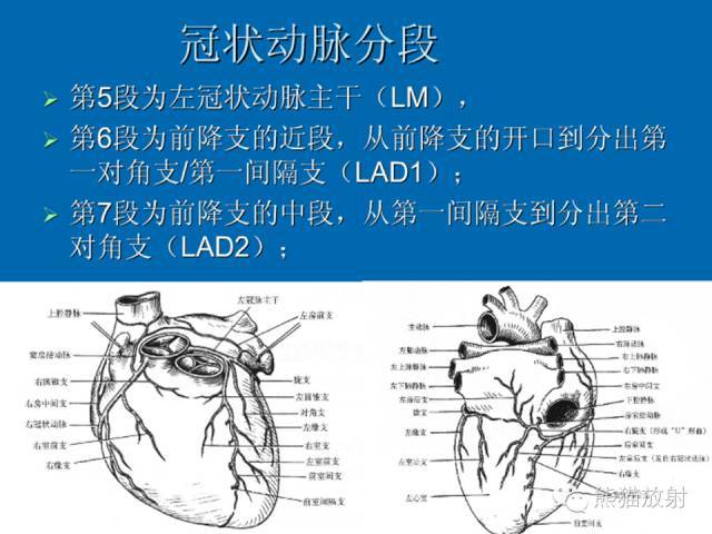 冠状动脉系统解剖,cta解剖,分段及中英文名称对照