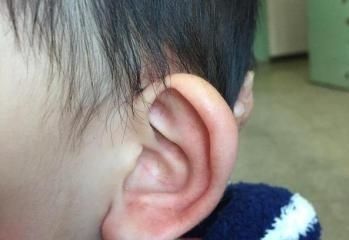 宝宝六个月,总是用手抓耳朵是怎么回事?6个原因,5个方法预防