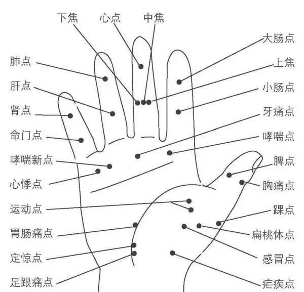 什么是扎四缝和十宣放血