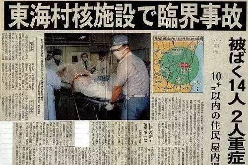 死法最痛苦的日本人:近距离遭核辐射后,医生对他强行救治了83天