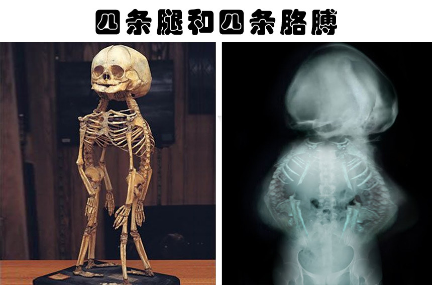 四条腿和四条手臂的人类盘点多年里人类找到的7个可怕的发现