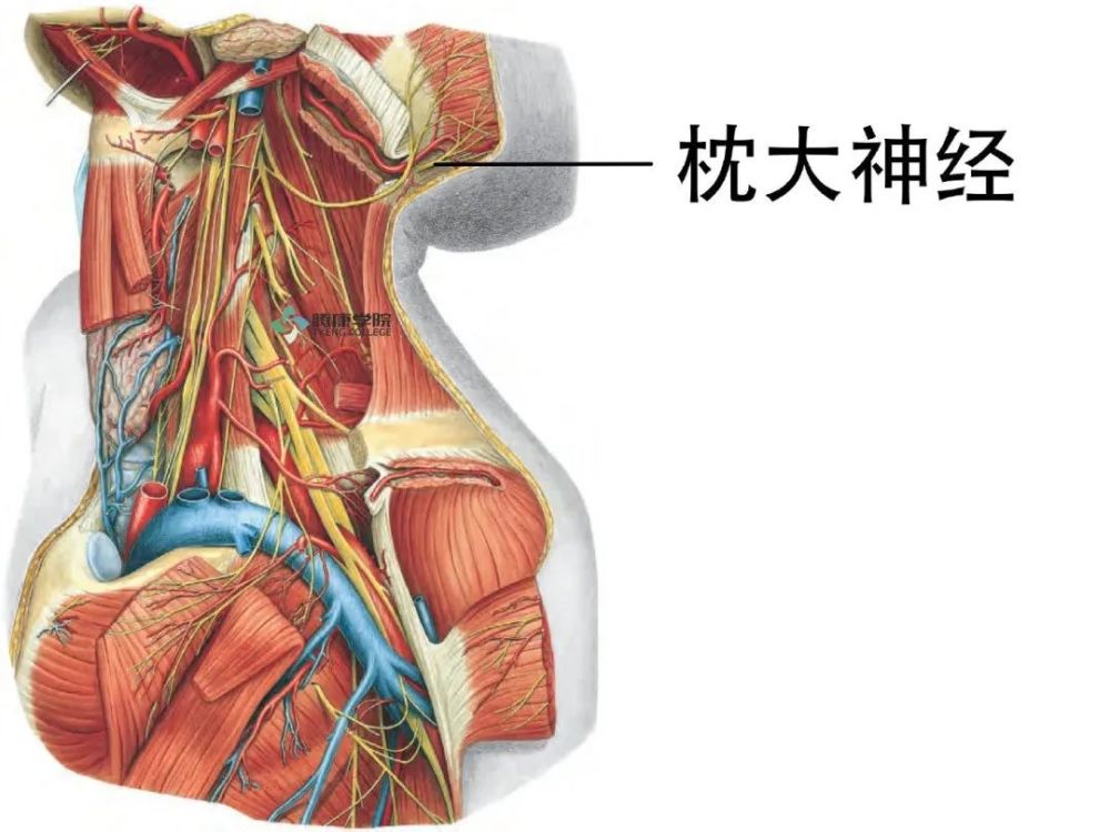 枕大神经卡压针刀治疗