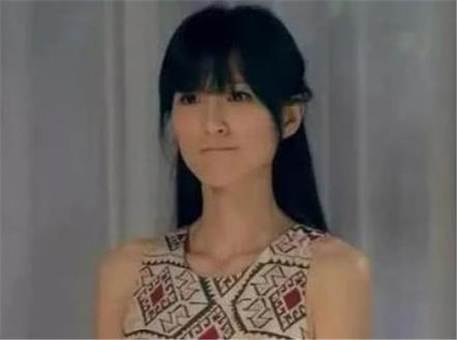 有种"整容"叫林宛瑜胖了,别人一胖毁所有,结果她却逆袭成女神