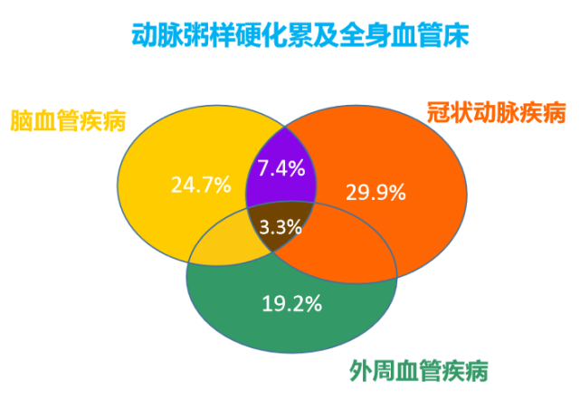 而动脉粥样硬化是各种心脑血管疾病的主要潜在原因,可