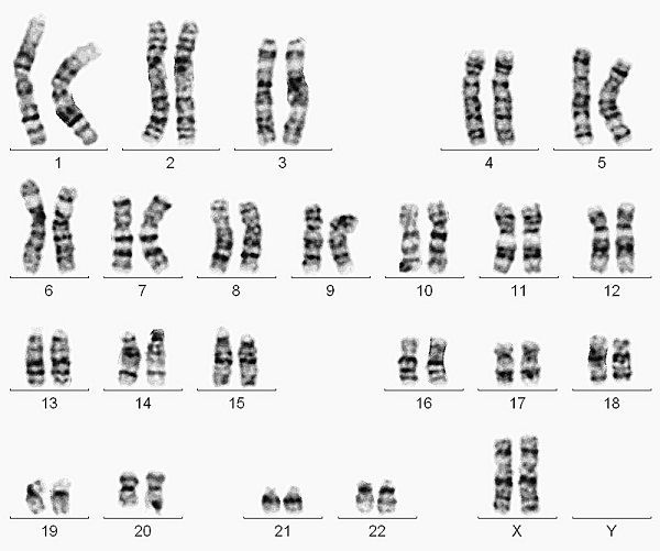 人类正常染色体核型图(女性:46,xx)