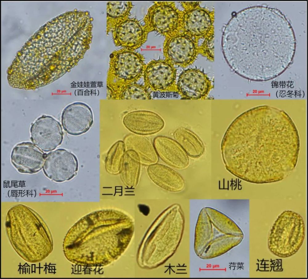 显微镜下的现代植物花粉(采自北京奥林匹克森林公园,由作者供图)