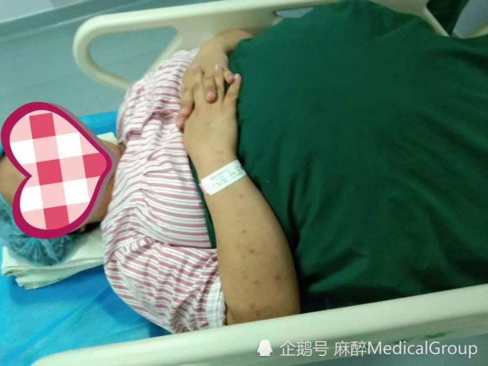 听说生孩子要在后背打麻醉,她恐惧极了