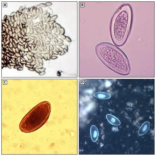 蛲虫卵  ▲图片来源:uptodate