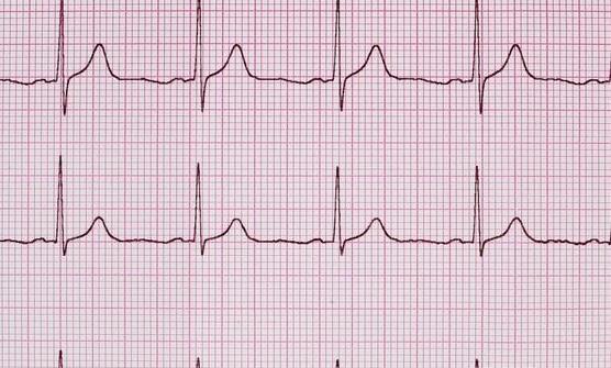 经常胸口不舒服心电图正常,怎么判断是否是心脏的问题