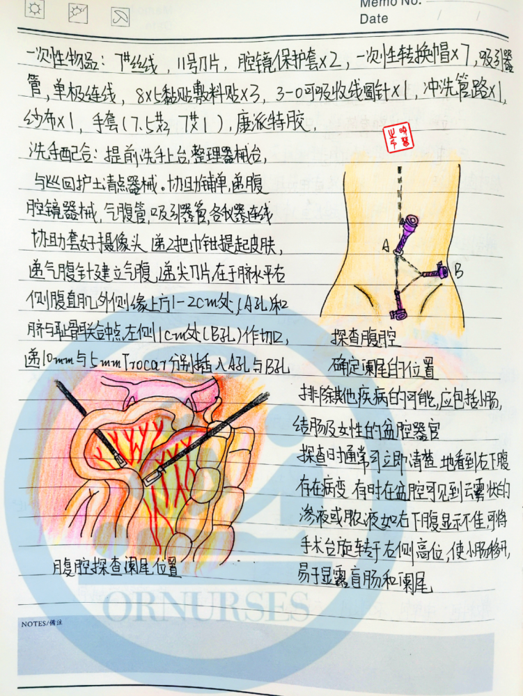 【手术笔记】腹腔镜下阑尾切除术