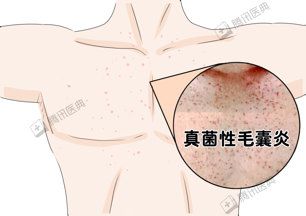 内衣有血_卫生巾图片有血(2)