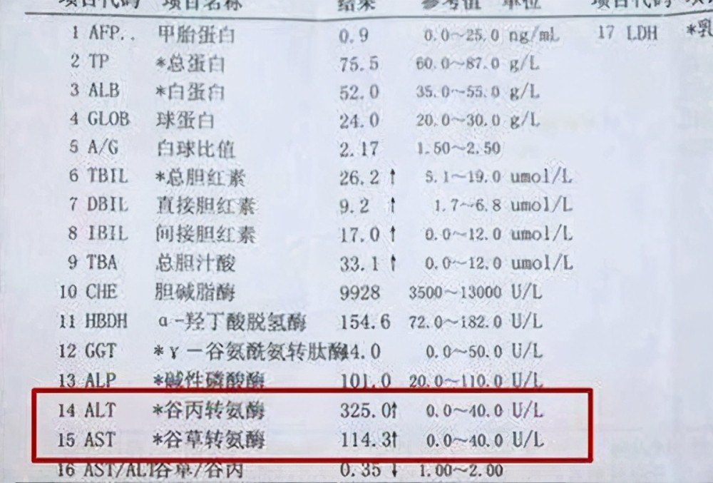 30岁男子转氨酶指标从120降到40,经验很重要,他的方法