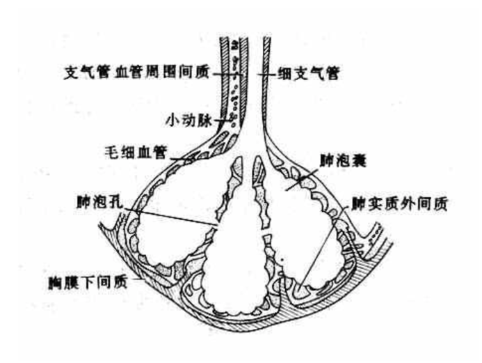 这种特殊性肺炎与哪些生活场景相关?