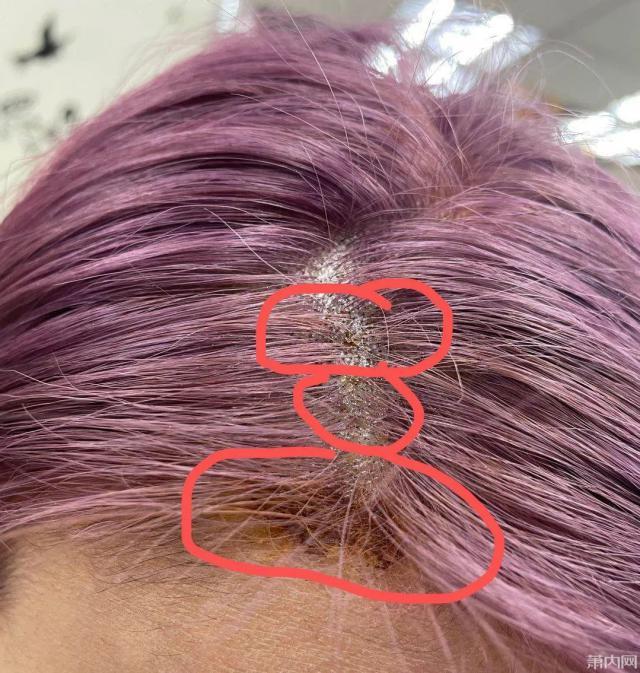洗发染头发什么原理_洗发前后头发对比照片(3)