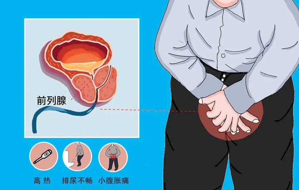 在排尿时,膀胱内的带菌尿液刺激尿道,就会有明显的