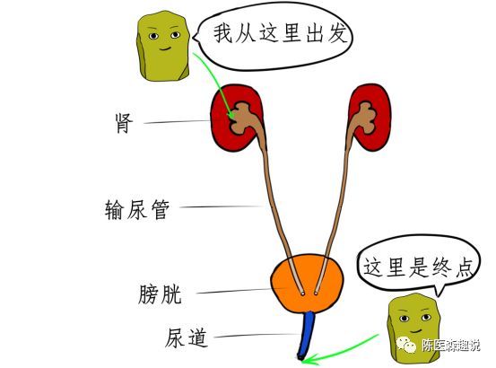 肾结石排出要多久参考西游记可得出答案