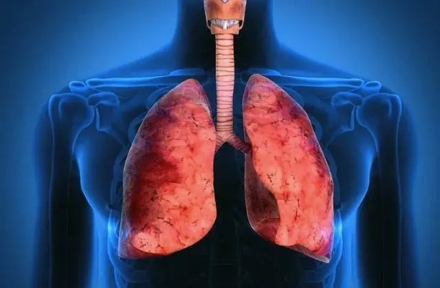 超过10年烟龄的烟民,多少岁前戒烟还能恢复肺状态?专家来告诉你