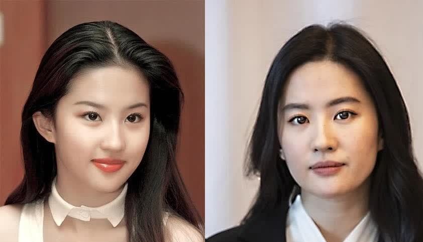 发腮是什么鬼?人脸的二次发育,腮帮子的另一个生长高峰