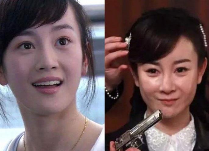 张檬整容失败后痛哭:"后悔整形",现在取出假体还不算晚