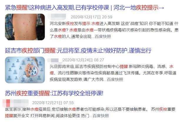 水痘一般不致命 但家长可千万不能轻视