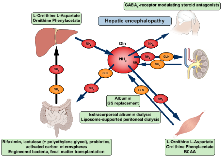 肝硬化高血氨和肝性脑病的多学科管理