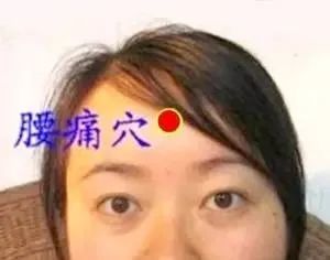 中医认为腰痛多由肝肾亏虚,气血瘀滞不通所致,额头正中的腰痛穴能活血