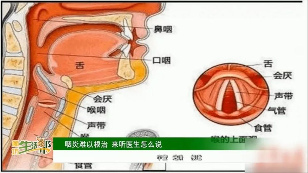 咽喉炎医院排名_咽喉炎医院单子图片
