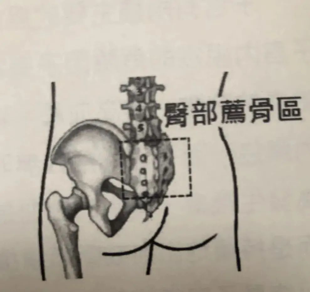 【臀部荐骨区】