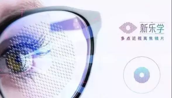 近视防控新方案离焦镜片全解析