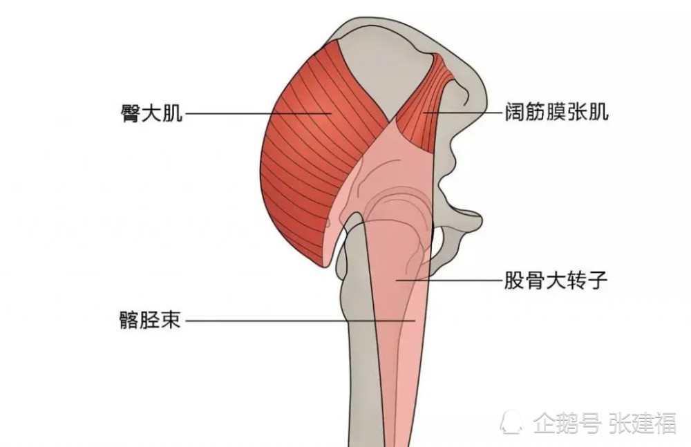 髂胫束挛缩