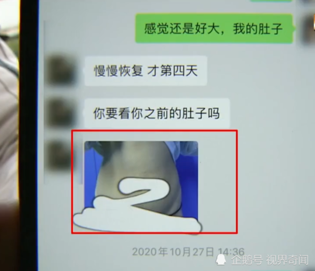 杭州一女子做整形后崩溃,胸部照片未打码,被发到500人