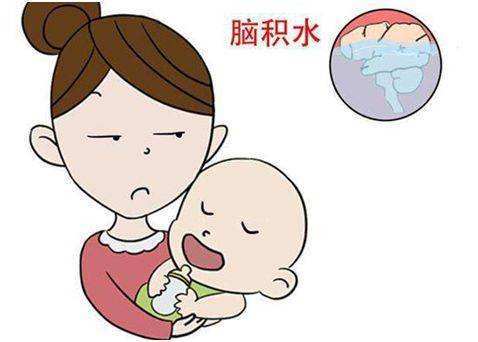婴幼儿脑积水有哪些症状