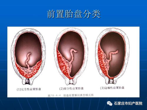 血盆 腾讯网