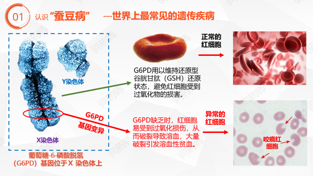 作为一名"蚕豆病宝宝"的药师老爸,我日常会解答很多"蚕豆病"宝宝用药