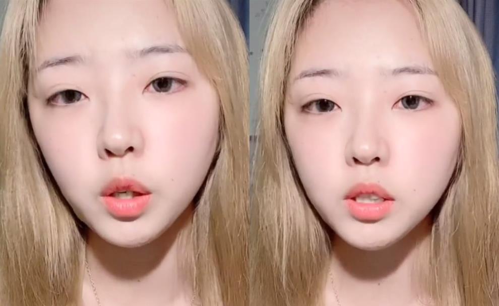网红郝一点素颜直播,卸妆后脸部变黑痘印明显,小娇妻真人也就这