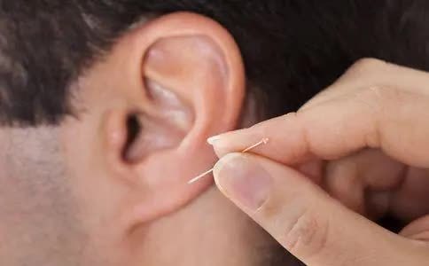 温州一男子耳朵疼痛难忍,医生从耳道里取出一只活的