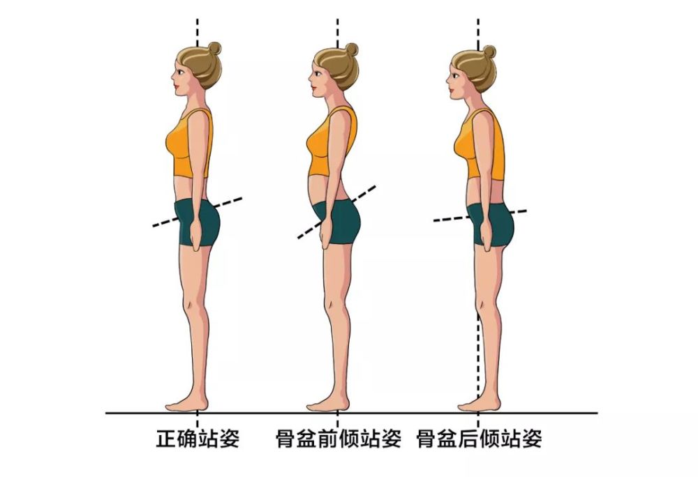 不良体态纠正攻略告别短信脖及骨盆前倾健康日历