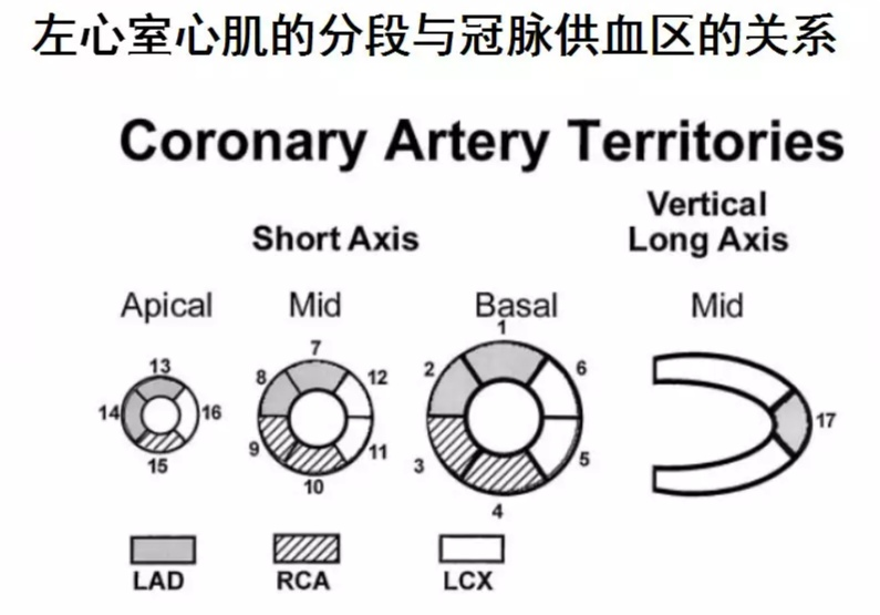 心脏磁共振成像中心肌节段如何划分