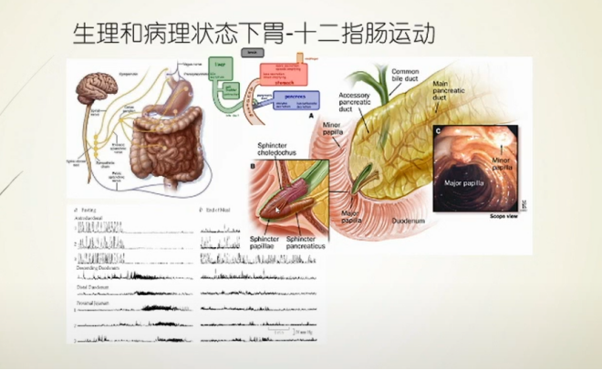 当人焦虑激惹时,交感神经兴奋,十二指肠蠕动增加,oddi括约肌被动开放